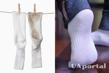Як позбутися чорних плям внизу шкарпеток