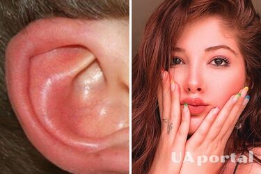 Что значит, когда горят уши и щеки