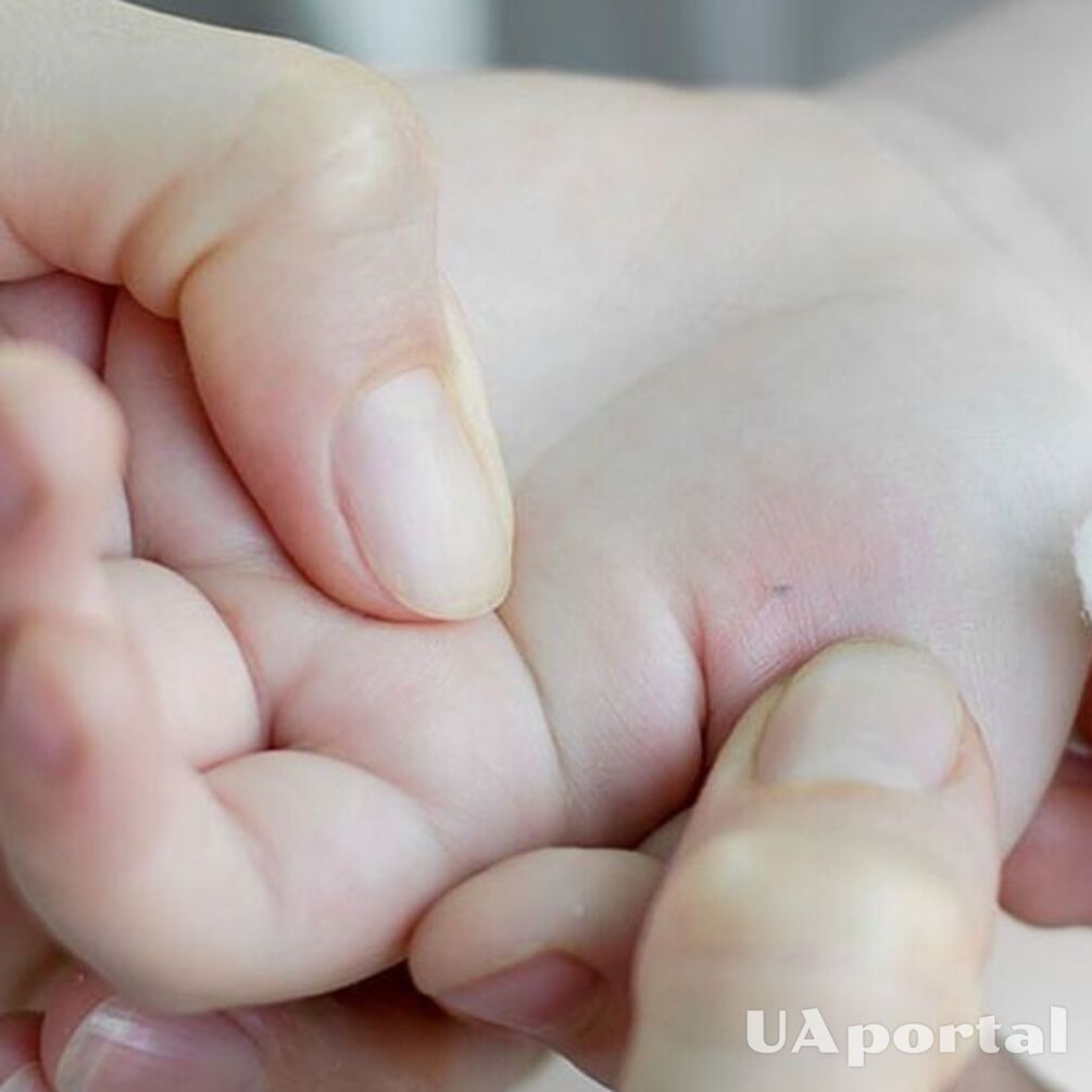 Как достать занозу из пальца без иголки: самые действенные лайфхаки