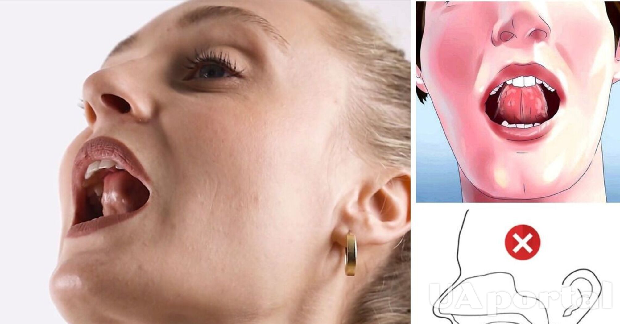 Чому не можна впирати язик в зуби і як знайти правильну позицію язика в роті