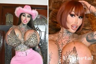 У известной канадской модели, увлекающейся пластикой, лопнул грудной имплант: как теперь выглядит Мэри Магдалена