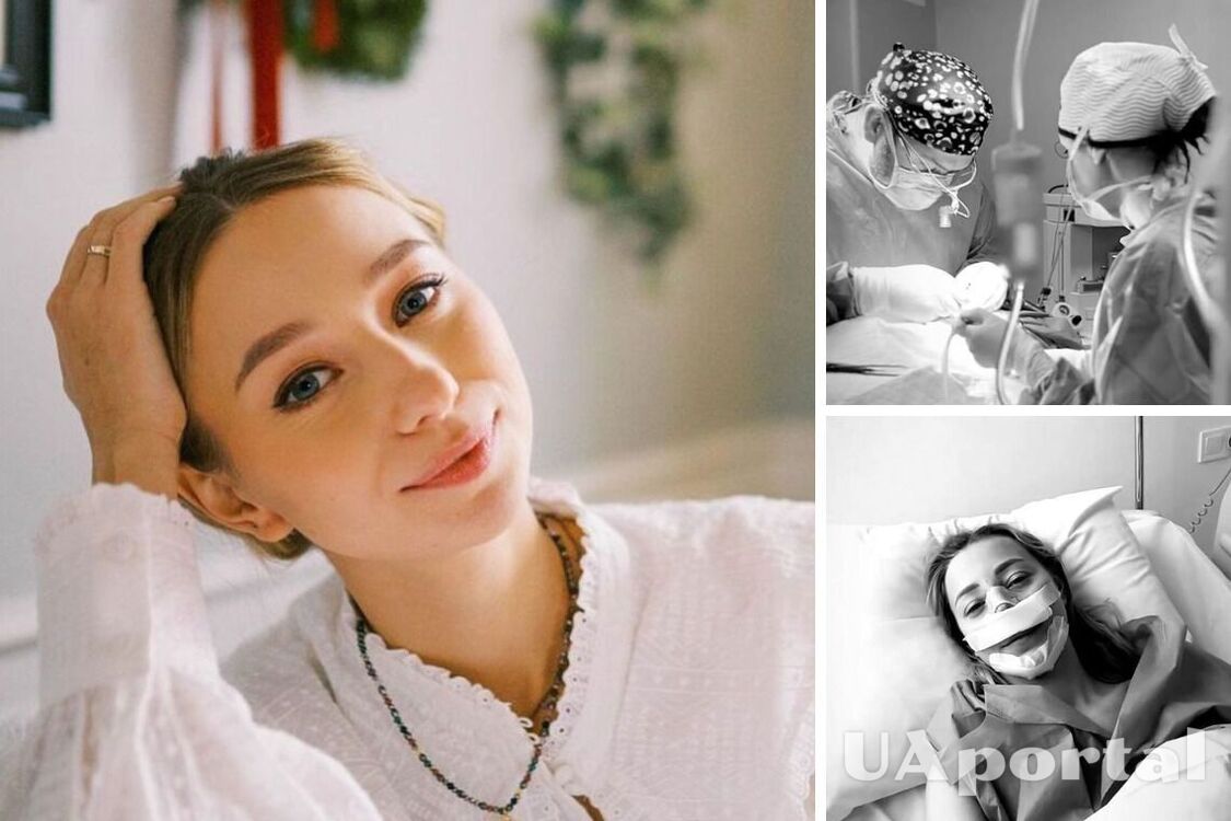 Дружина Віктора Павліка зробила пластику на обличчі: який вигляд має та скільки коштує операція