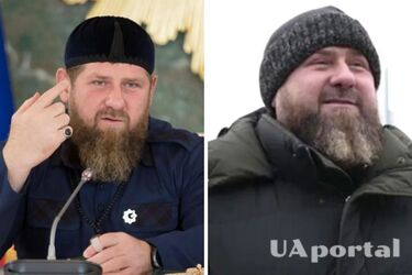 Погладшав та набряк: ЗМІ повідомляють про проблеми зі здоров'ям у Кадирова