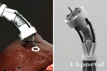 Способен печатать ткани прямо в теле: ученые показали инновационного робота (видео)