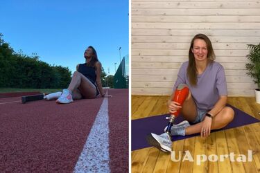 Blogger, for whom Odesa residents collected money for a prosthesis, is glad she fled to Russia (video)