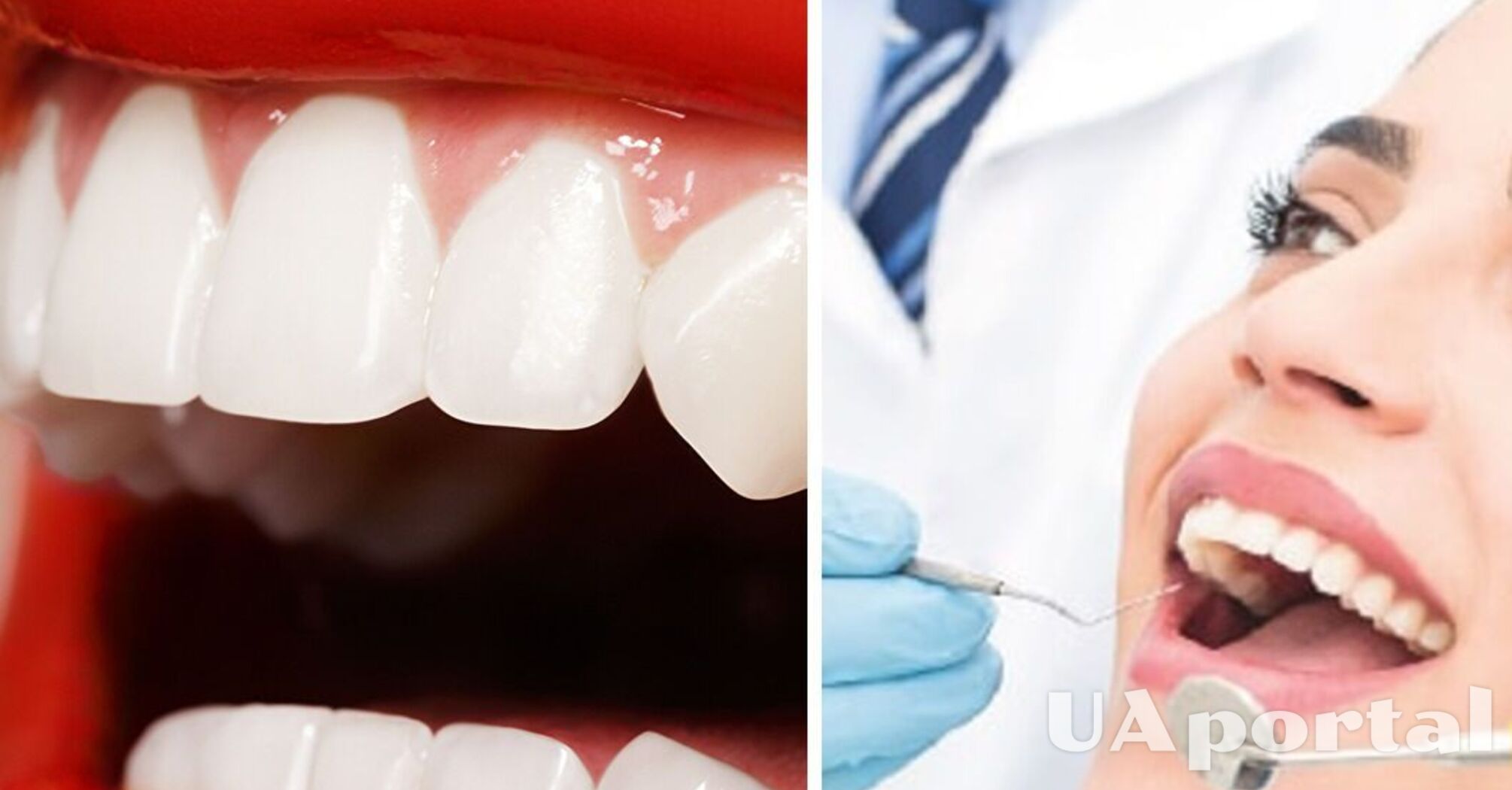 Dentists named foods that help maintain healthy teeth