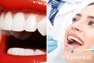 Стоматологи назвали продукти, які допомагають зберегти здоров‘я зубів