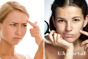 Milk and improper care: what habits spoil your skin