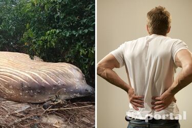 Сидение в китовых трупах: как лечили ревматизм в конце 19 века