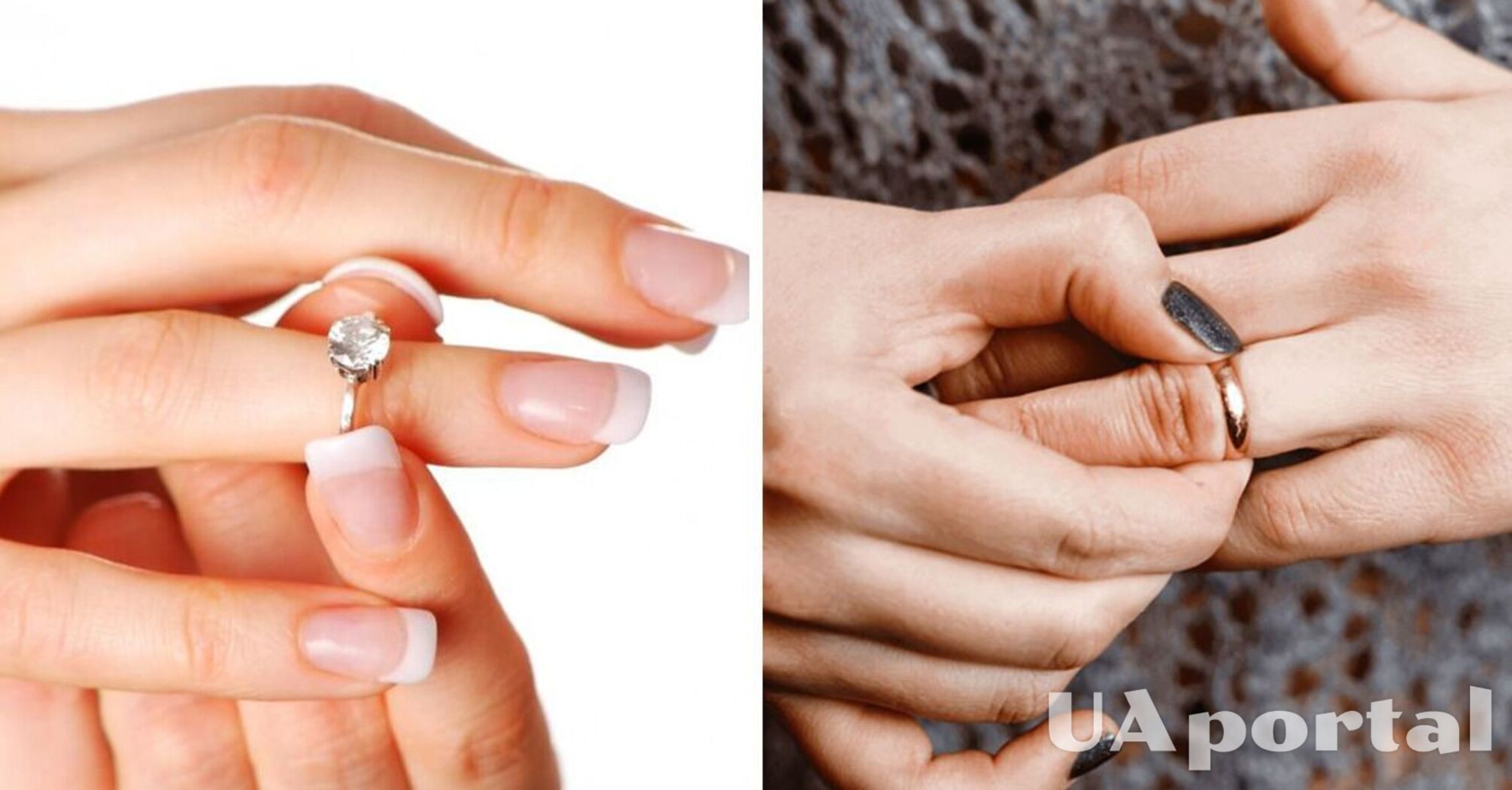 How to remove a ring stuck on your finger: 3 easy ways