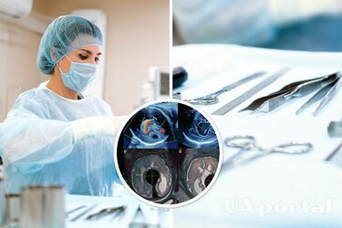 Унікальна операція: лікарі прооперували мозок дитини, яка знаходилася в утробі матері
