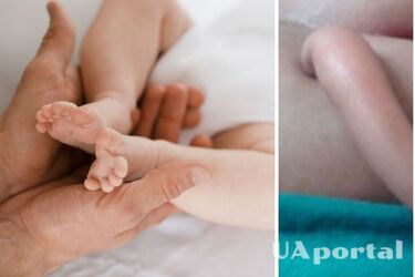 Вчені пояснили, чому деякі діти народжуються з 'хвостиками'