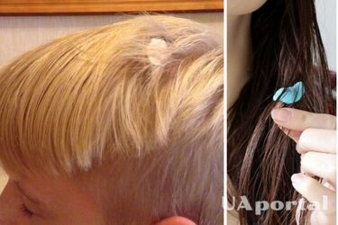 Як прибрати жувальну гумку з волосся не зістригаючи пасма