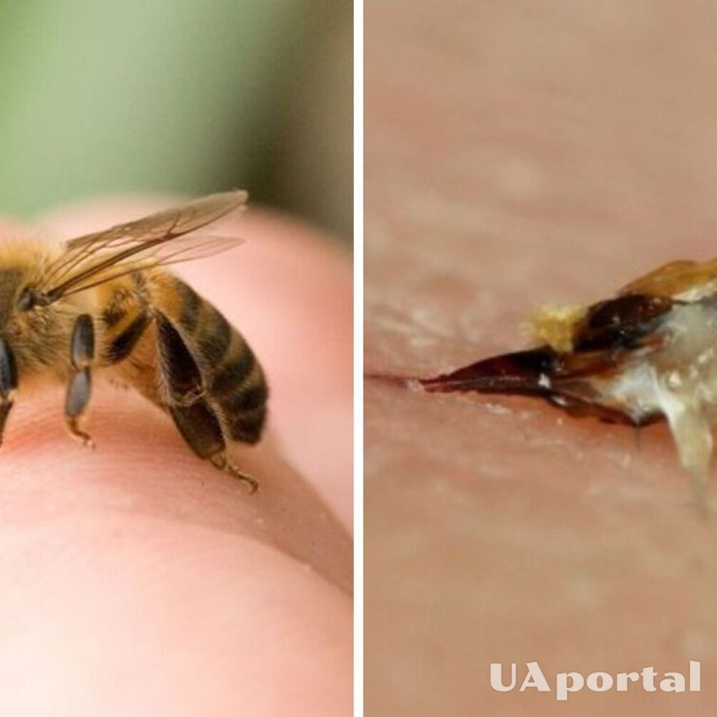 Що робити після укусу бджоли: топ-3 дієві засоби для зменшення болю 