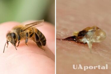 Що робити після укусу бджоли: топ-3 дієві засоби для зменшення болю 