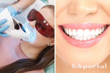 Teeth whitening: which method is the best