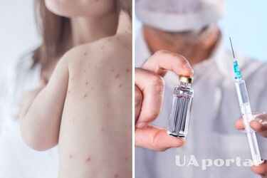 Высок риск развития серьезных осложнений: кто в первую очередь нуждается в прививке против кори