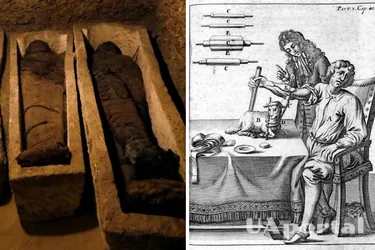 Странные методы нетрадиционной медицины в истории человечества