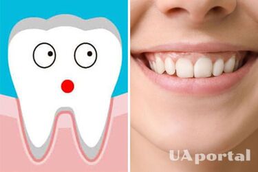 Ученые хотят создать препарат для отращивания зубов