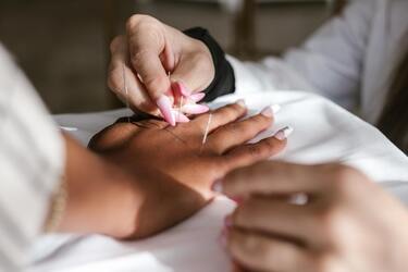 Do you need to do acupuncture