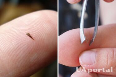 How to pull a thorn out of your finger if you don't have a needle at hand