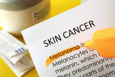 Загар как стресс: советы защиты кожи от старения и рака