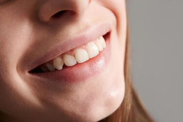 Как остановить желтение зубов