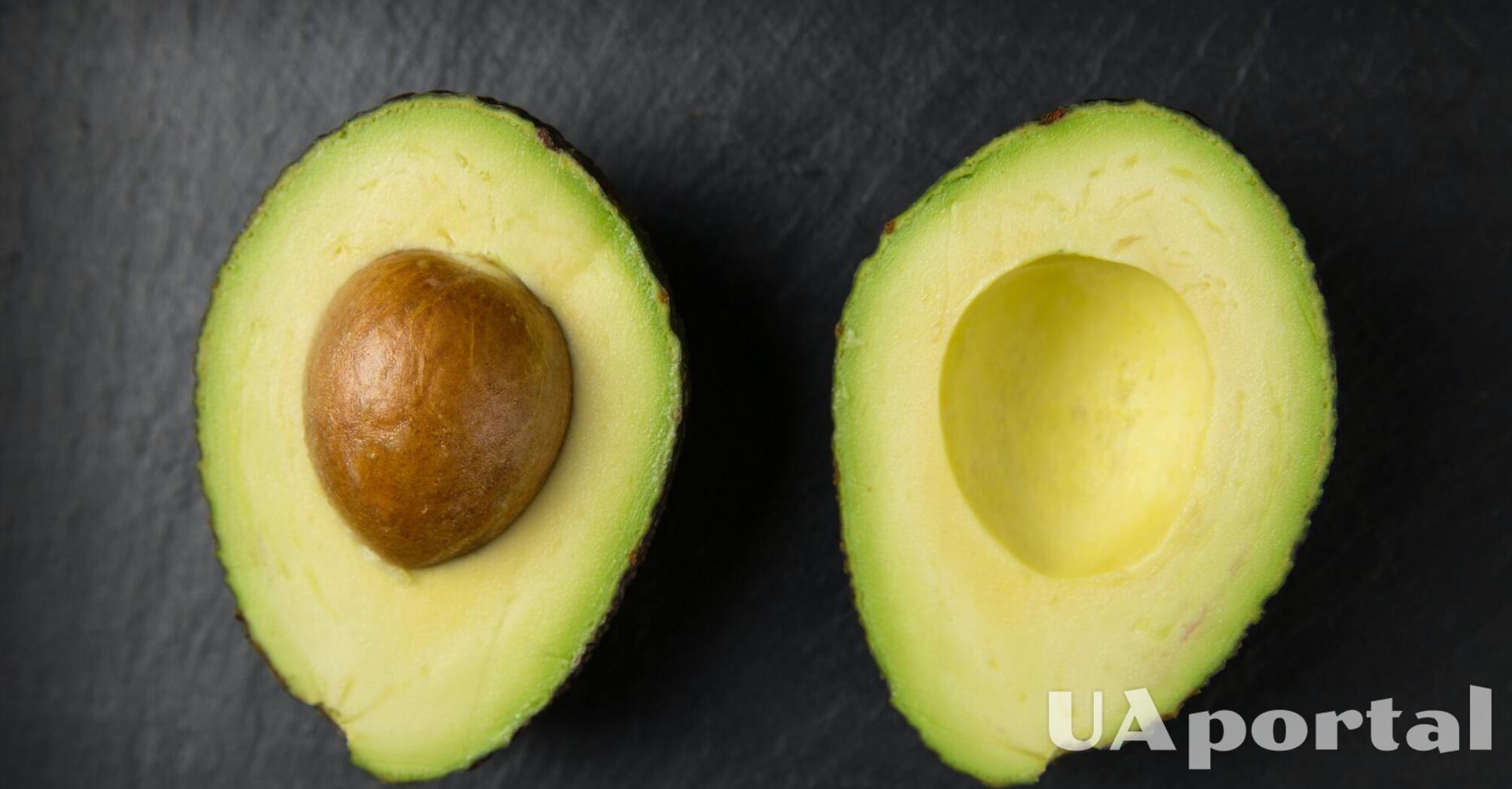 Nutritionist explains whether you can eat too much avocado