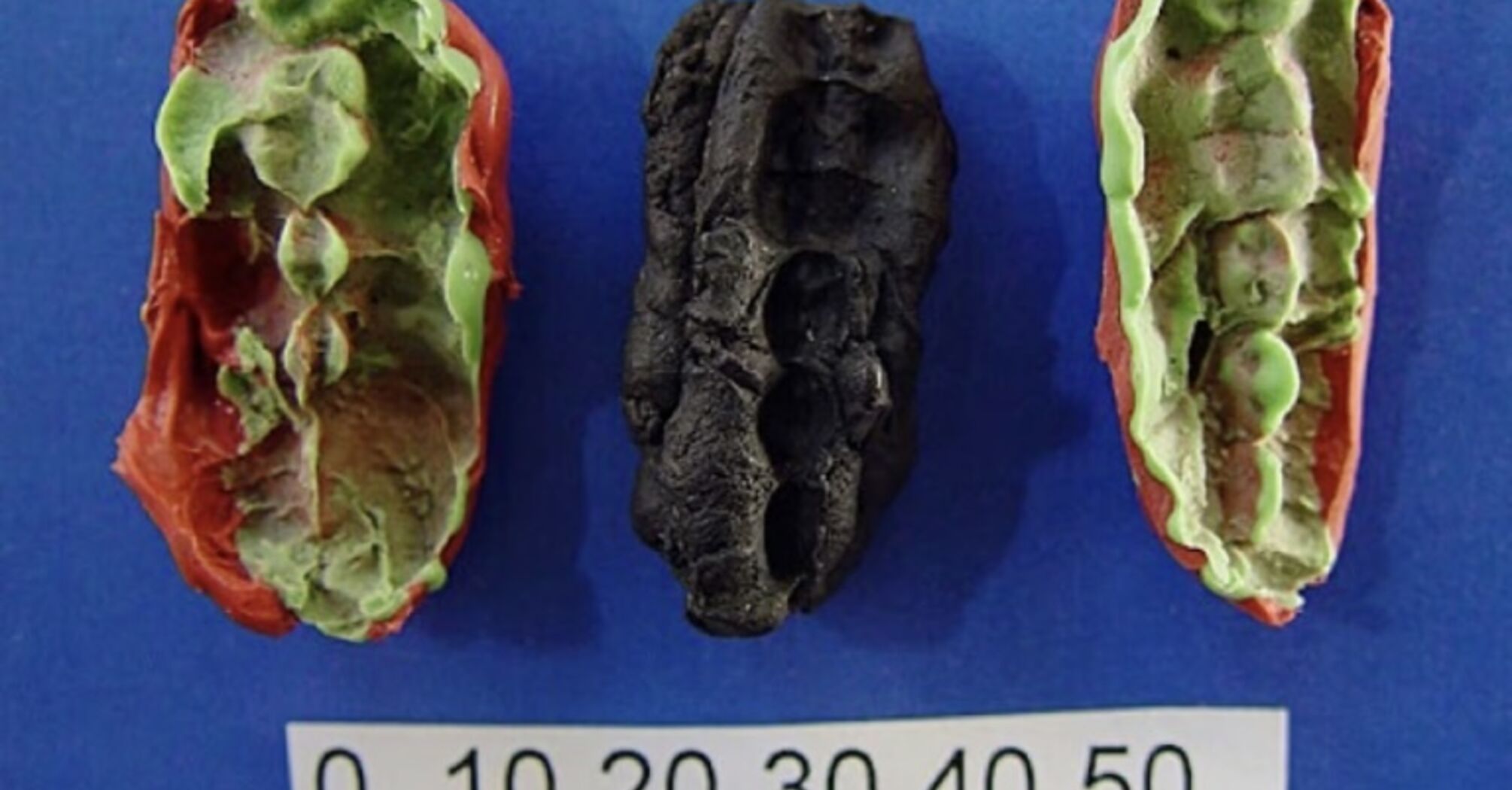 У Швеції знайшли жуйку віком 10 тисяч років: показує, які проблеми з зубами мали древні люди 