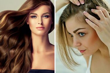 When hair loss signals illness: what to pay attention to
