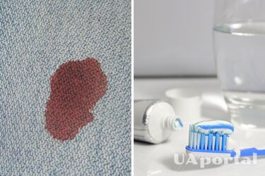 Специалисты объяснили, как легко вывести засохшие пятна крови из одежды