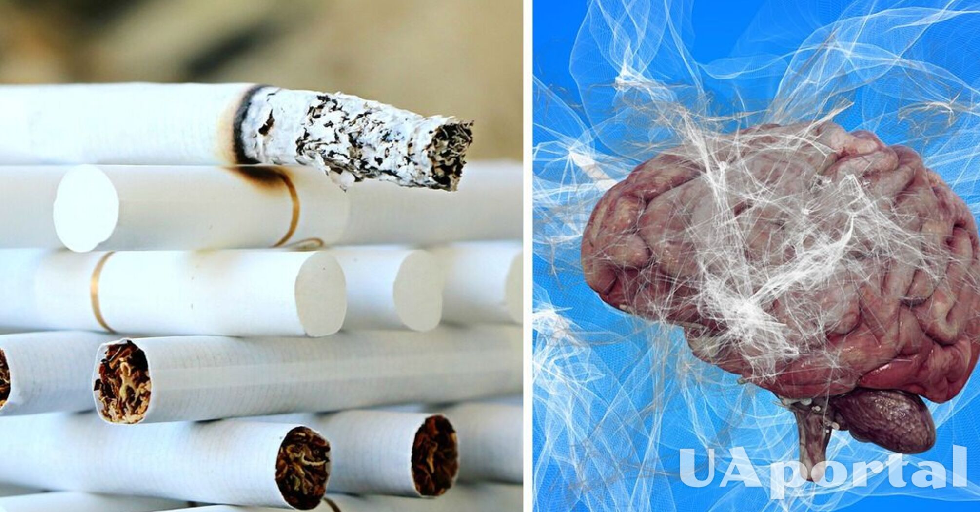 Вчені виявили, що куріння спричиняє зменшення мозку