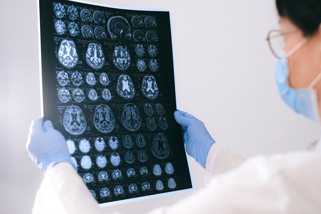 Проривна терапія: науковцям вдалося знищити смертельну пухлину мозку за кілька днів
