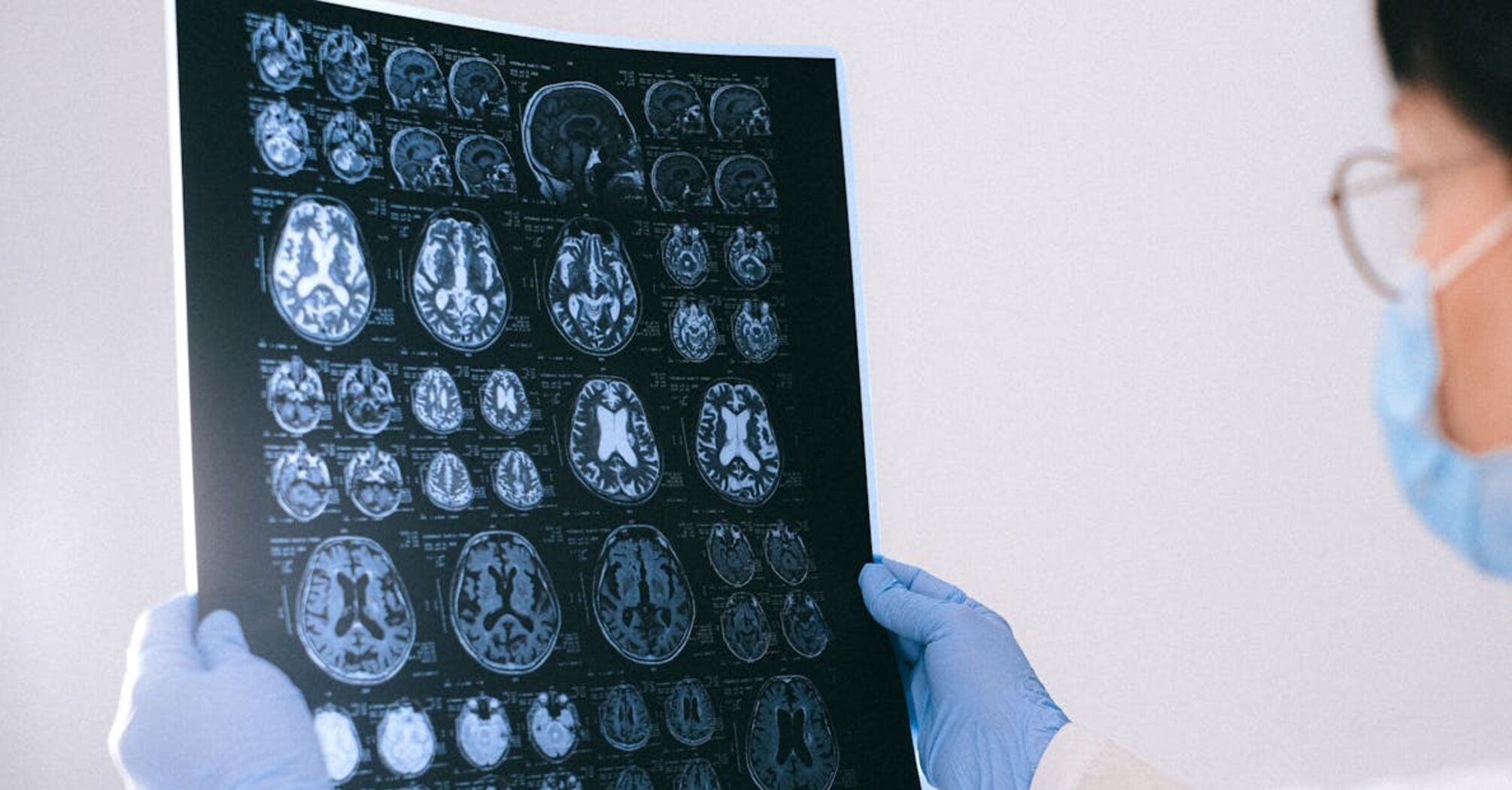 Breakthrough therapy: scientists managed to destroy a deadly brain tumor in a few days