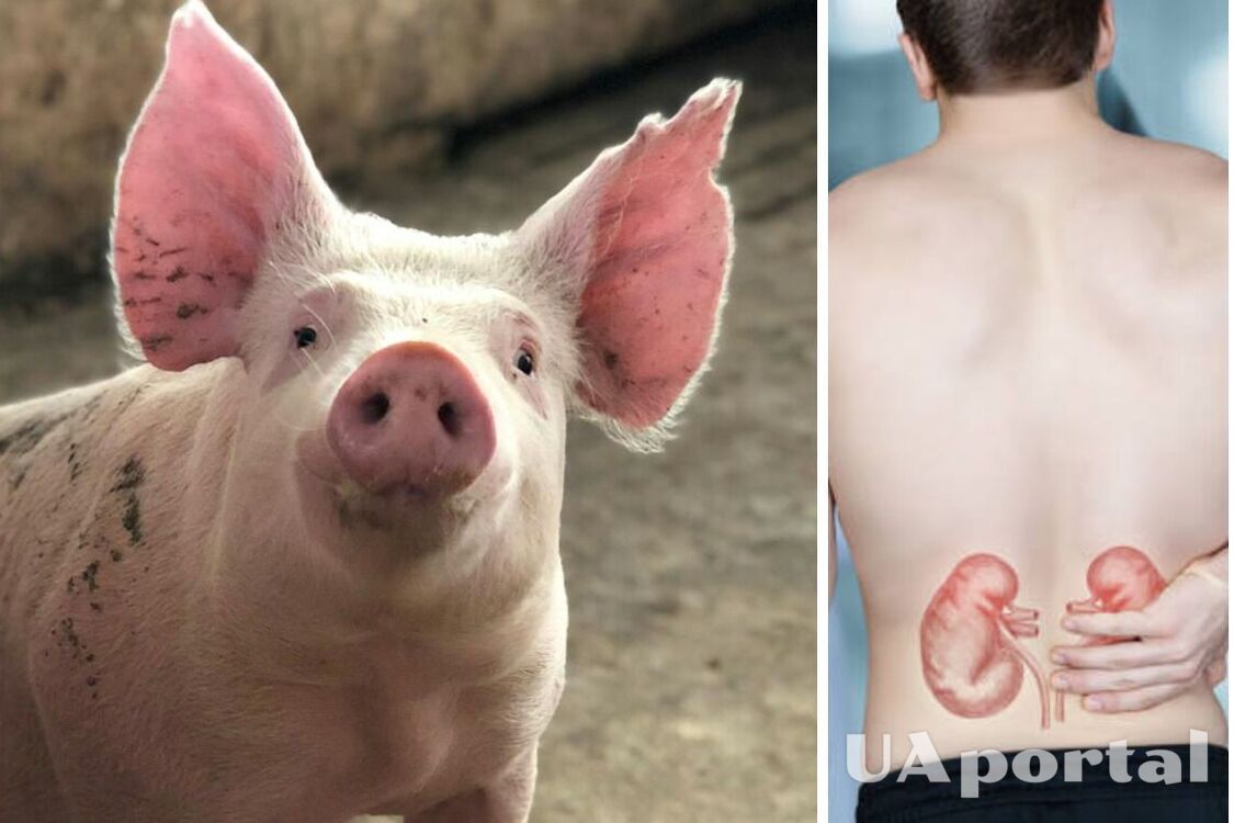 Вперше у світі: генетично модифіковану нирку свині пересадили людині