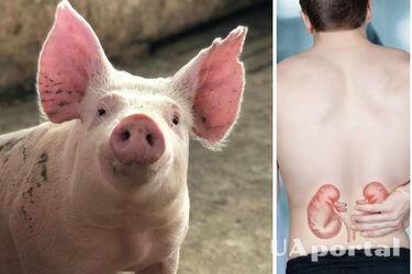 Вперше у світі: генетично модифіковану нирку свині пересадили людині