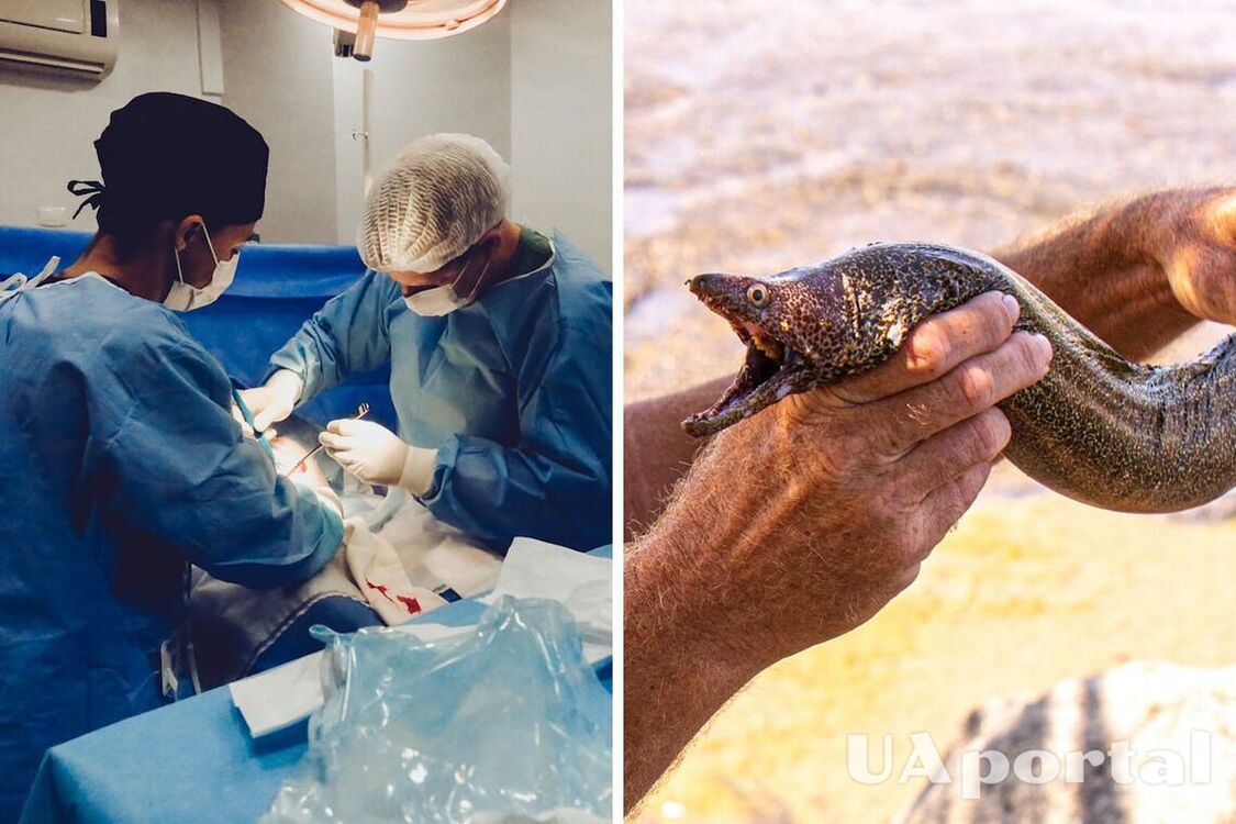 Врачи во время операции обнаружили внутри пациента живое 30-сантиметровое существо (фото)