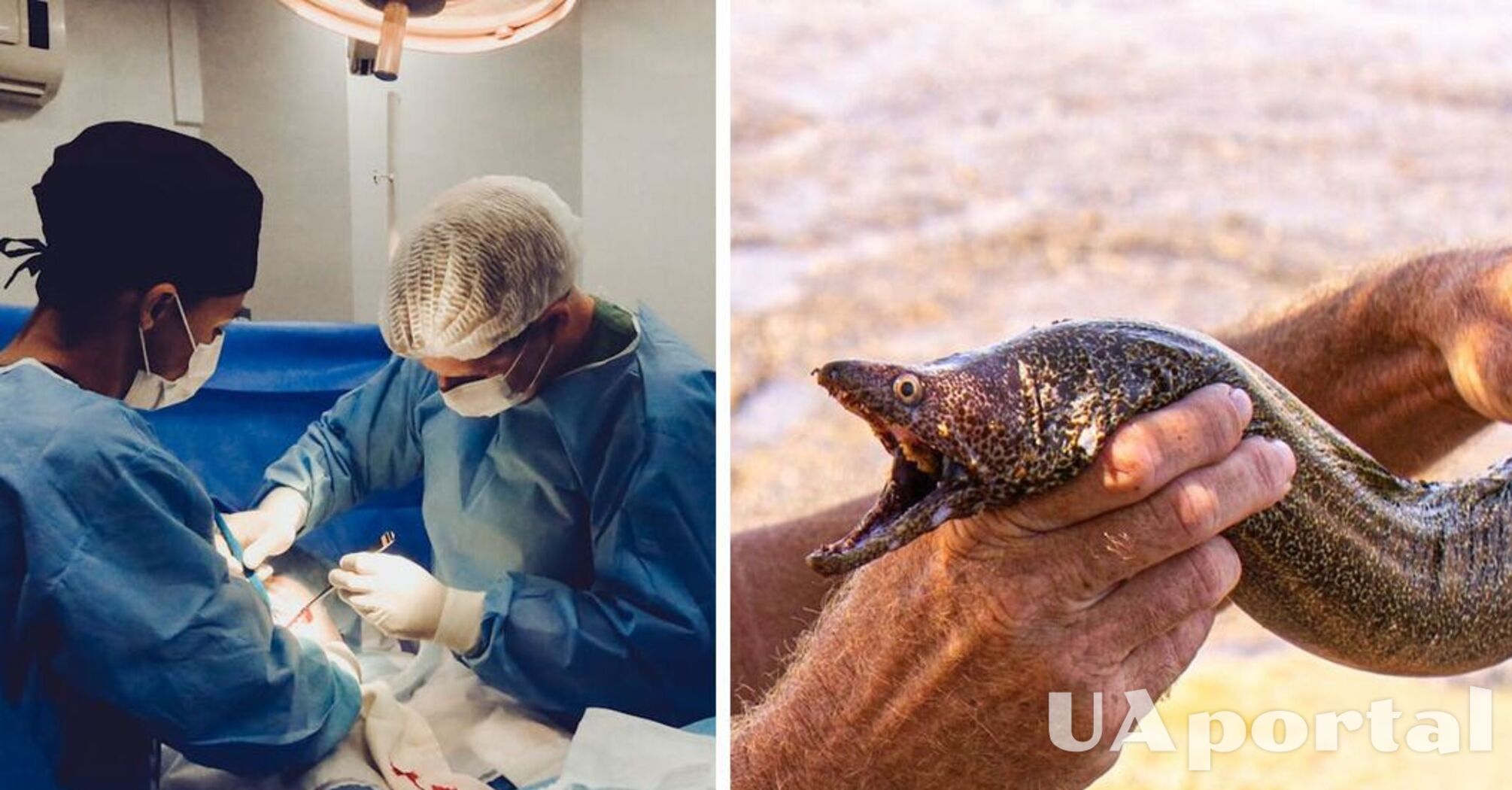 Врачи во время операции обнаружили внутри пациента живое 30-сантиметровое существо (фото)