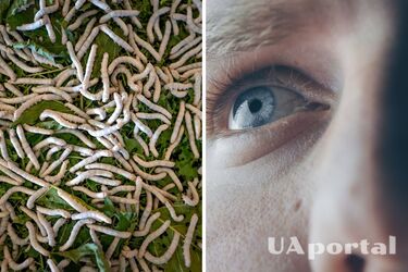 Doctors removed 150 live larvae from an American's nose (video)