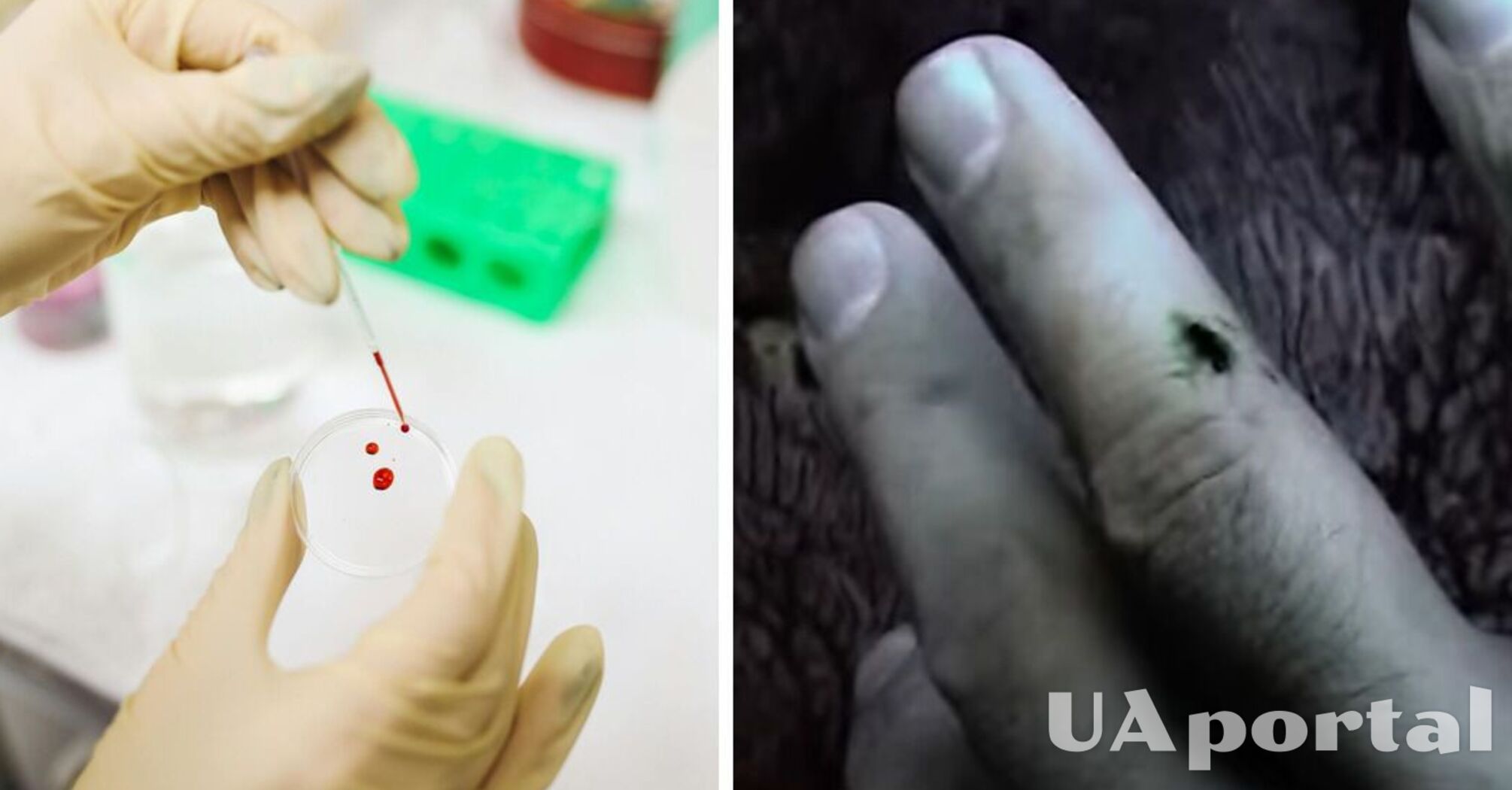 Ученые показали видео, как человеческая кровь становится зеленой