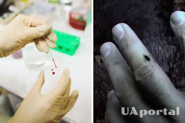 Науковці показали відео, як людська кров стає зеленою