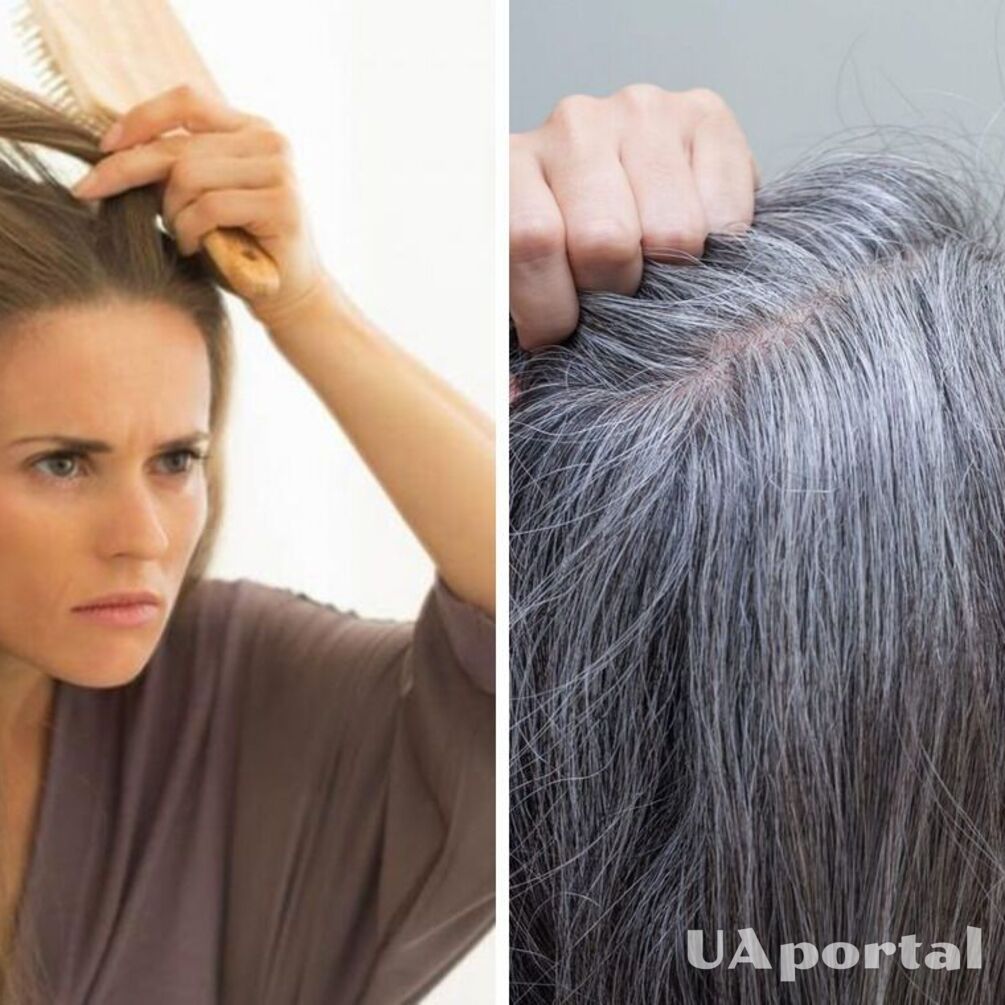 Ранняя седина и выпадение волос: недостаток какого витамина в организме свидетельствует об этих неприятностях.