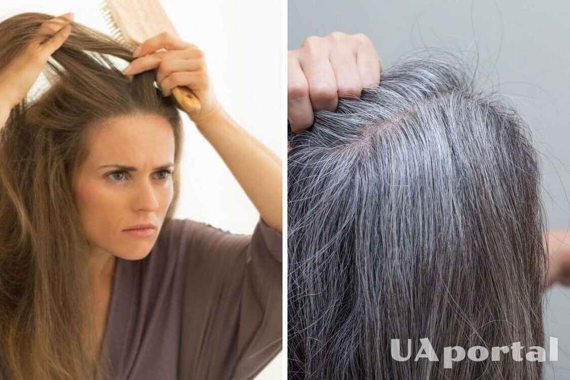 Рання сивина та випадіння волосся: нестача якого вітаміну в організмі свідчить про ці неприємності 