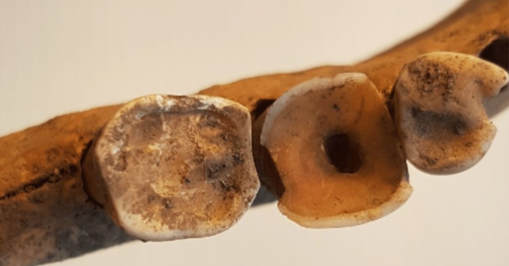 Вікінги і стоматологія: археологи виявили докази розвиненої медицини у середньовіччі (фото)