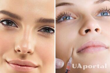 Як приховати носогубні складки за допомогою макіяжу