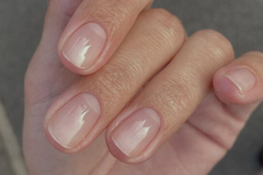 На які захворювання вказують негаразди з нігтями