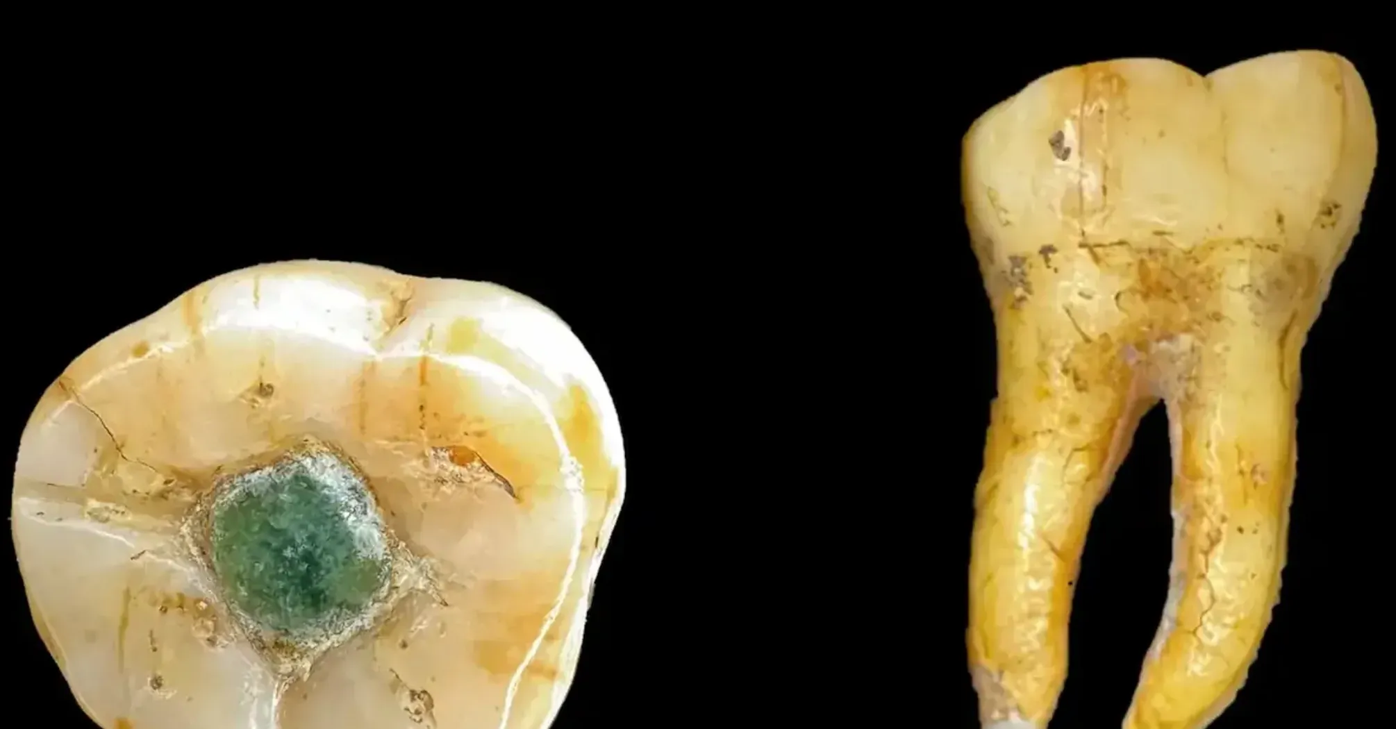 Ученые ответили, зачем майя вставляли в зубы драгоценные камни (фото)