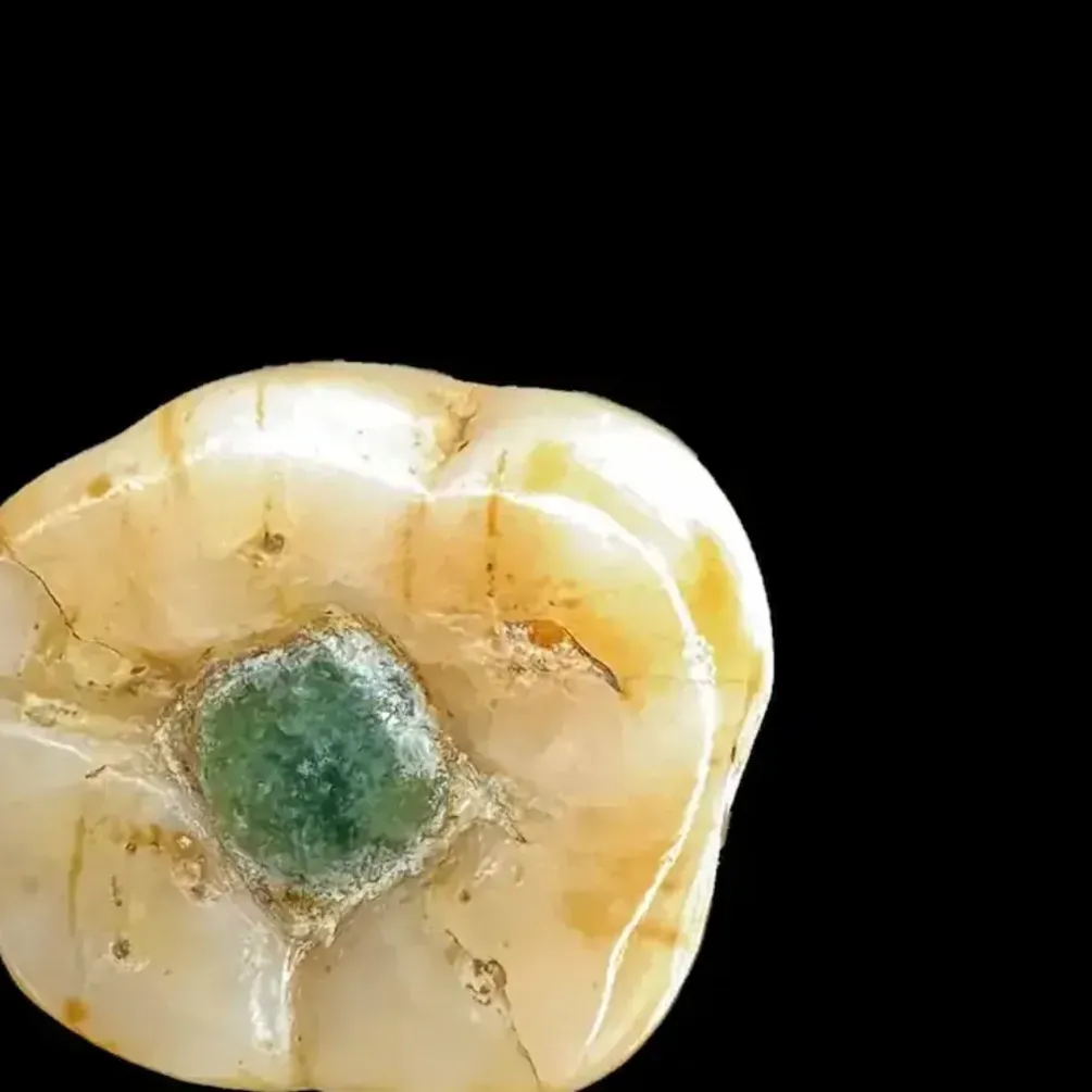 Вчені відповіли, навіщо майя вставляли у зуби дорогоцінні камені (фото)