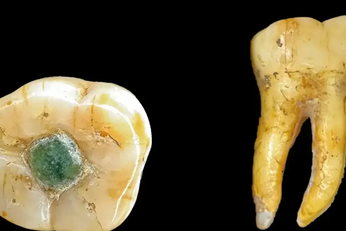 Ученые ответили, зачем майя вставляли в зубы драгоценные камни (фото)