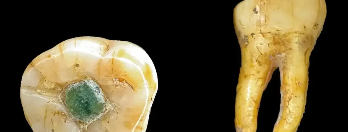 Ученые ответили, зачем майя вставляли в зубы драгоценные камни (фото)